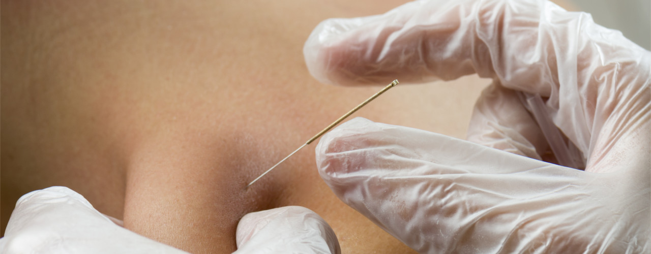 zenlife-physiotherapy-and-wellness-calgary-ab